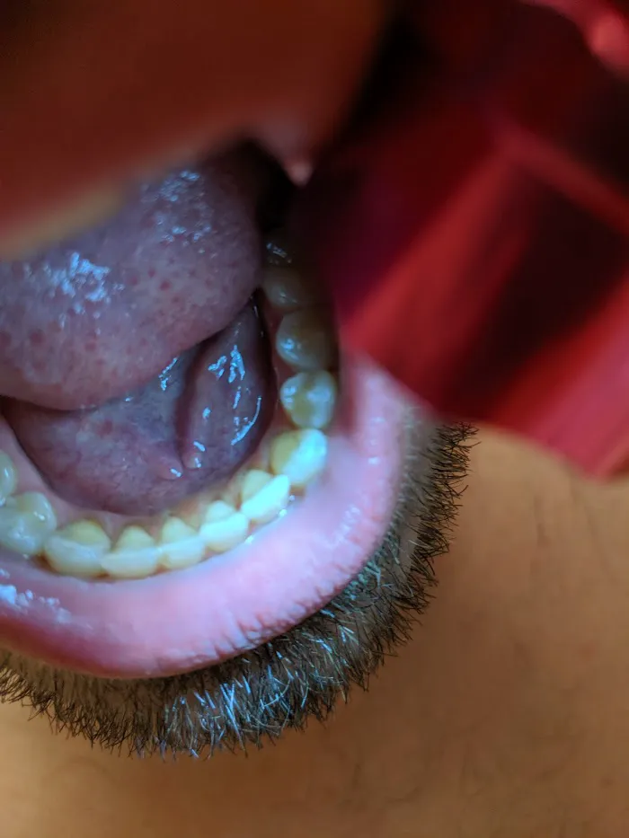 Seattle Sound Dental - Downtown Picture 7