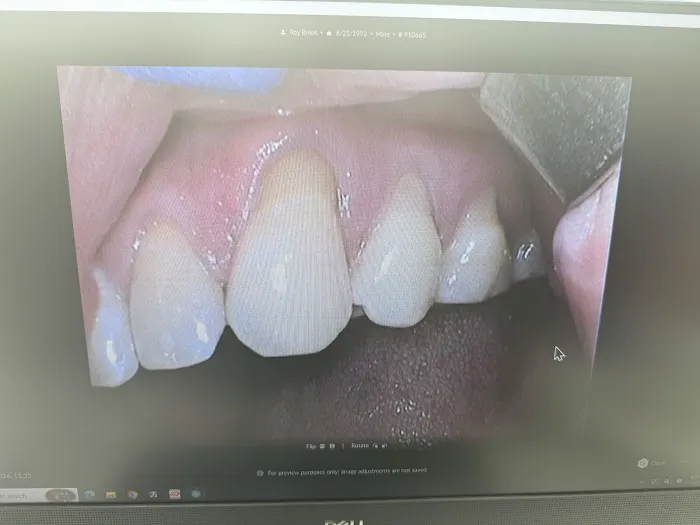 Capitol Hill Seattle Dentist Picture 3