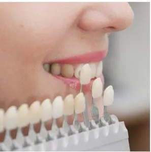Seattle Dental & Denture Arts Picture 6