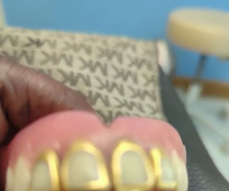 Affordable Dentures & Implants