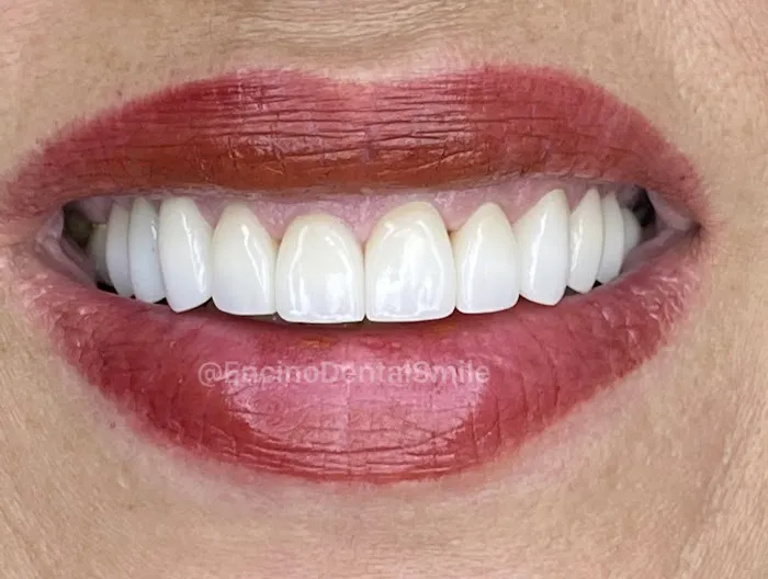 Encino Dental Smile Picture 4