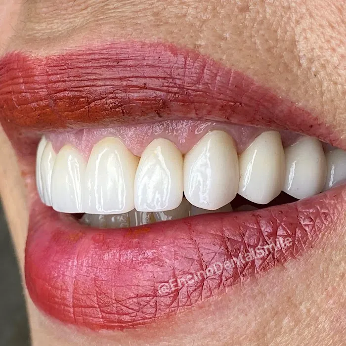 Encino Dental Smile Picture 6