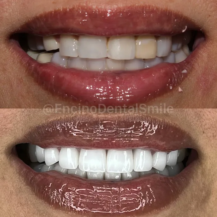 Encino Dental Smile Picture 5