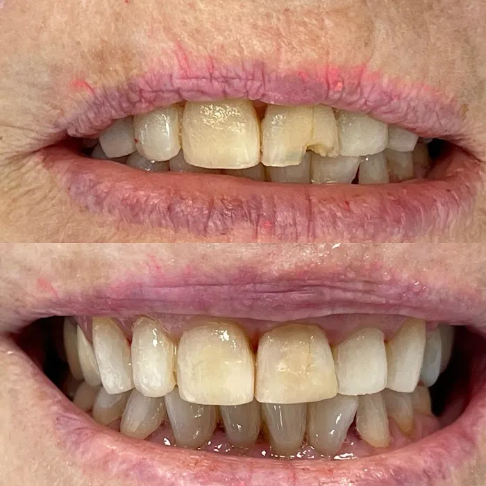Give Dental Picture 2