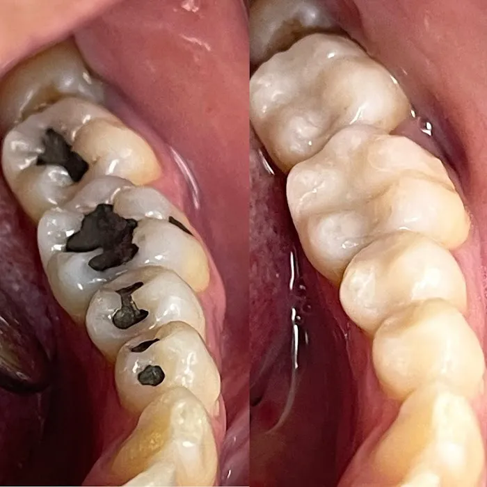 Give Dental Picture 4