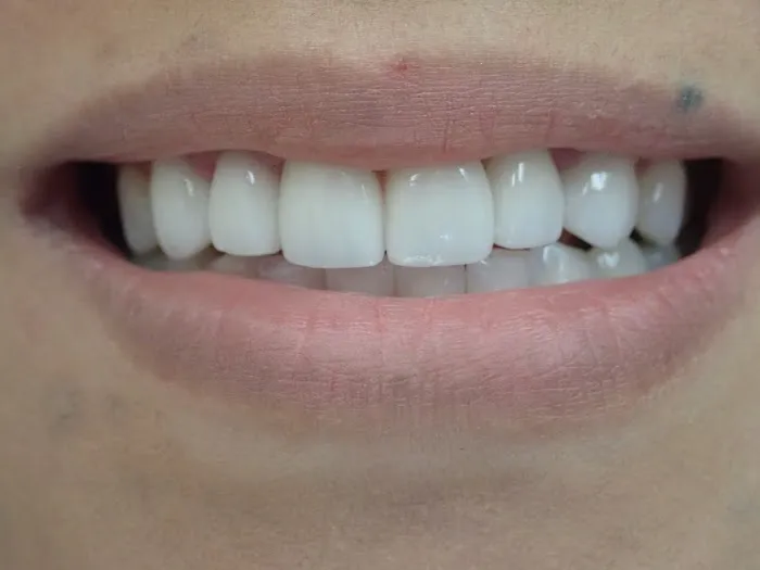 Studio City Dental Arts Picture 9