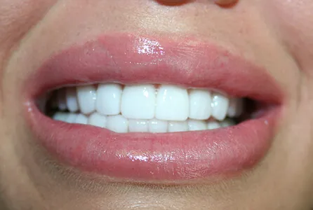 Studio City Dental Arts Picture 3