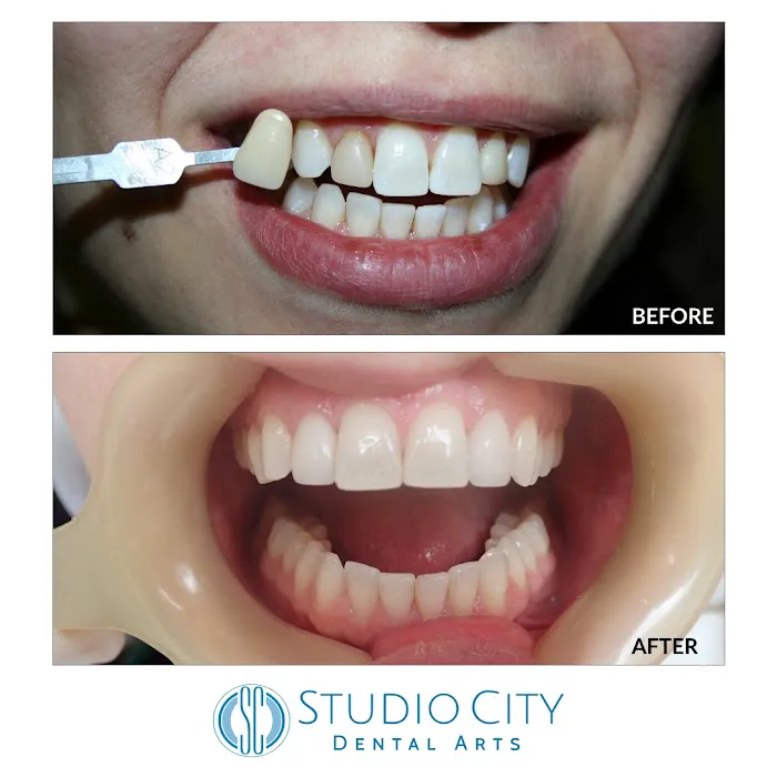 Studio City Dental Arts Picture 5