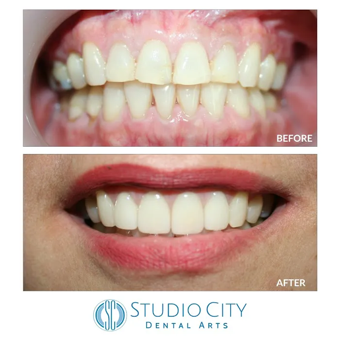 Studio City Dental Arts Picture 8