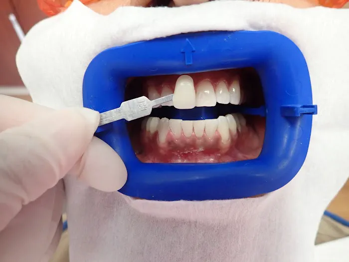 Studio City Dental Arts Picture 4