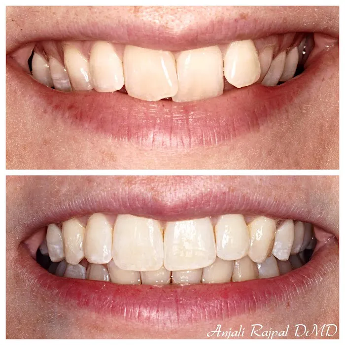 Beverly Hills Dental Arts | Dr Anjali A Rajpal | Dentist Picture 9