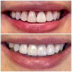 Glen Dental Studio: Stepan Harutyunyan, DMD