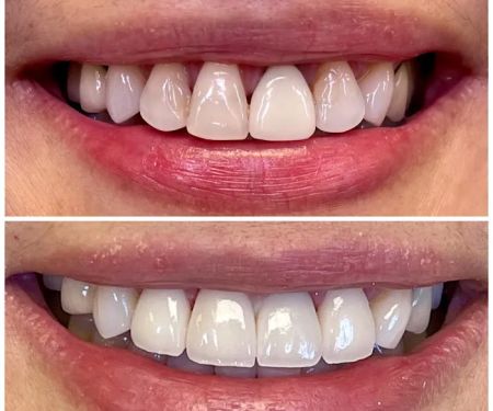 Glen Dental Studio: Stepan Harutyunyan, DMD