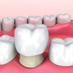 South Gate Smile Dental