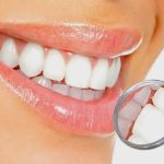 Harbor Dental Care