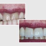 Dr. Nader Nikman D.D.S - Brentwood Center for Cosmetic Dentistry