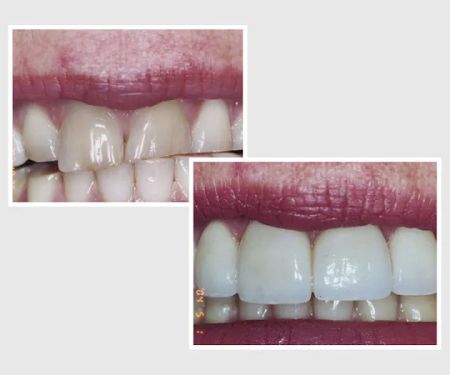 Dr. Nader Nikman D.D.S - Brentwood Center for Cosmetic Dentistry