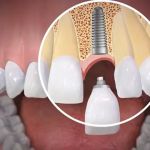 Singley & Crane Family Dentistry