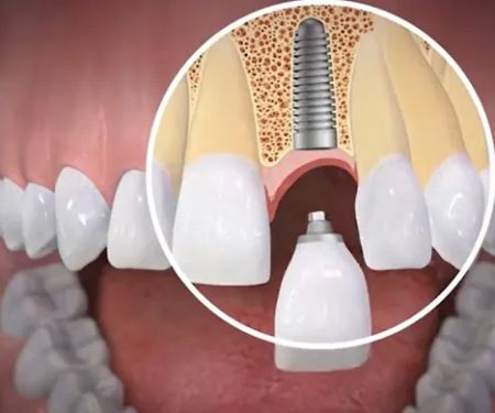 Singley & Crane Family Dentistry
