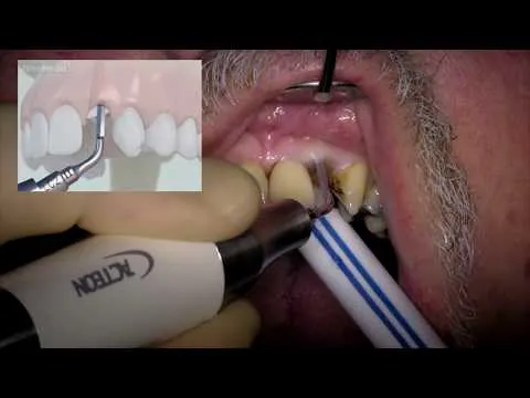 Reston Family Dental Center Picture 7