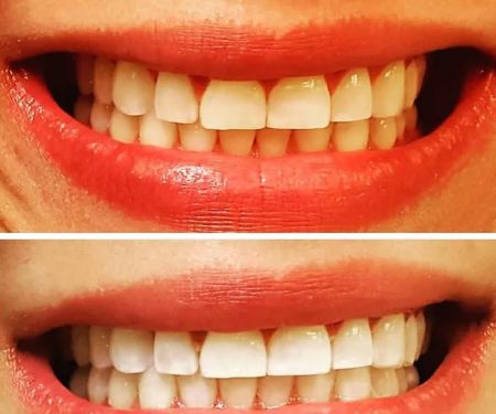 Redwood Dental Centre