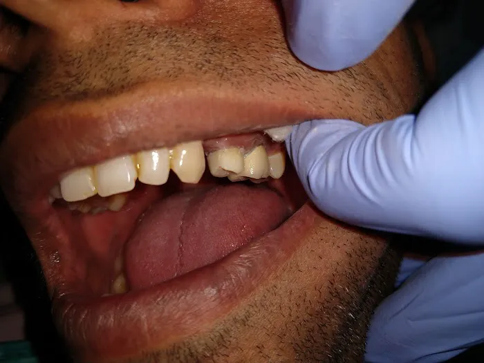 Cure Dent Dental Clinic (Implants /Braces/Invisalign) 4