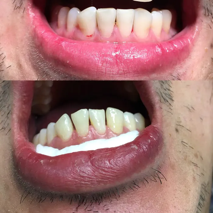 Fine Dental Arts/ Kianoosh Behshid, DDS, FAGD Picture 8