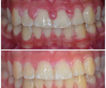 LA Periodontics & Implant Specialists