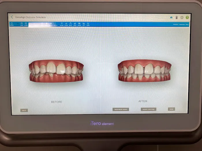 Dr. Kevin Kang, DDS: Cosmetic Dentistry & Clear Aligners 2