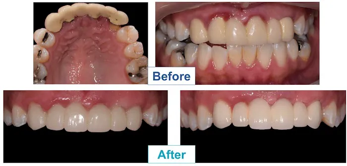 Dr. Kevin Kang, DDS: Cosmetic Dentistry & Clear Aligners 3
