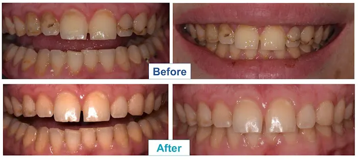 Dr. Kevin Kang, DDS: Cosmetic Dentistry & Clear Aligners 4