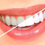 Elite Dental Group Andre Eliasian DDS