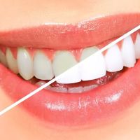 Elite Dental Group Andre Eliasian DDS ico
