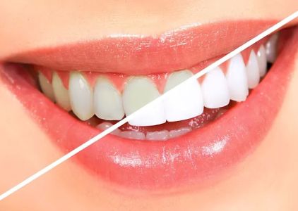 Elite Dental Group Andre Eliasian DDS