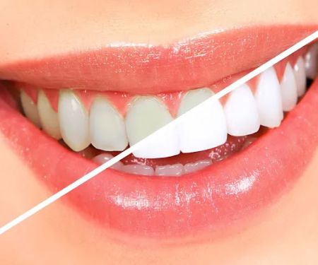 Elite Dental Group Andre Eliasian DDS