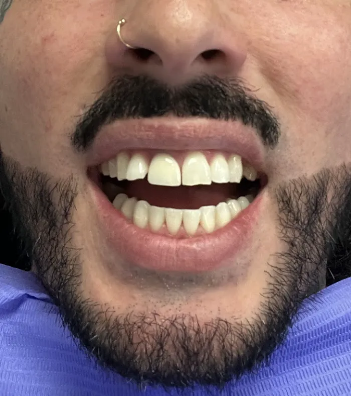 Restore Dental Picture 8