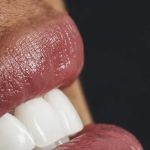 Carpe Diem Dental Spa