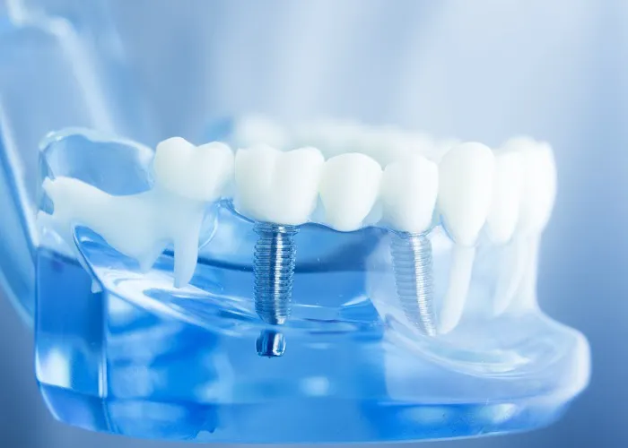 Affordable Dental East: Ben Mohrman, DDS 2