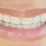 Parkview Dental