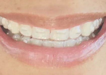 Parkview Dental