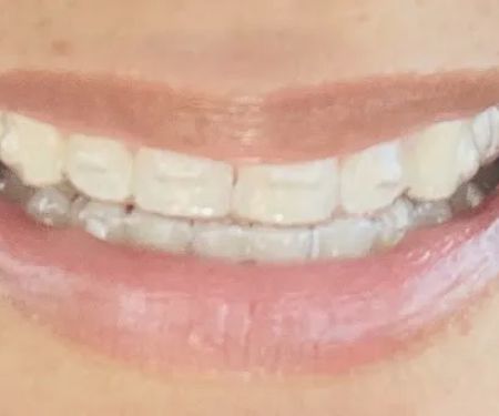 Parkview Dental