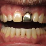 All-In-One Dental