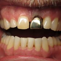 All-In-One Dental ico