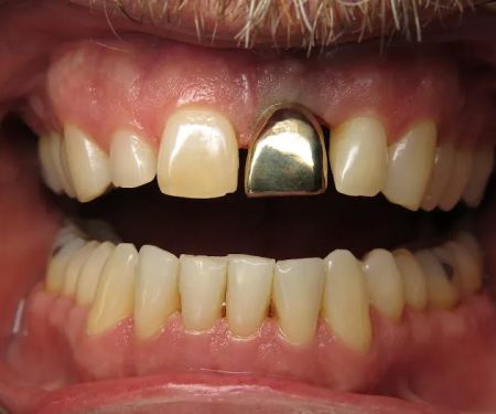 All-In-One Dental