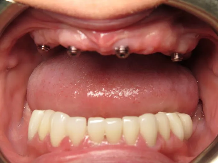 All-In-One Dental 3