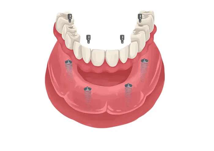 La Costa Family Dental and Implant Center Picture 1