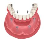 La Costa Family Dental and Implant Center