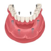 La Costa Family Dental and Implant Center ico