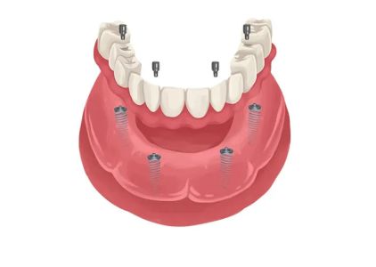 La Costa Family Dental and Implant Center