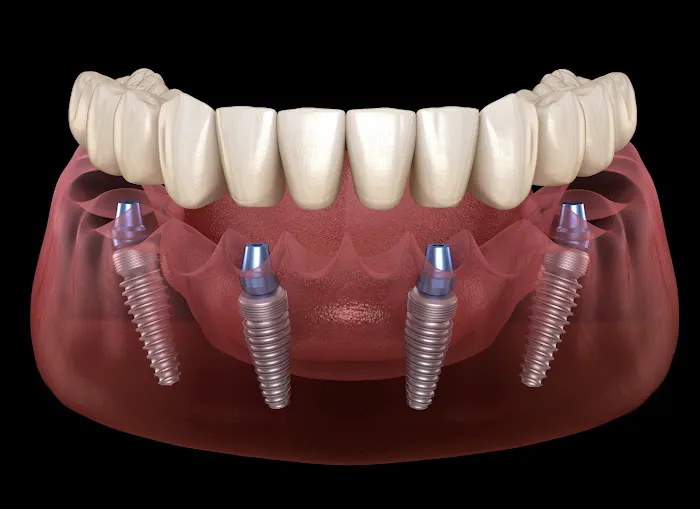 La Costa Family Dental and Implant Center Picture 4
